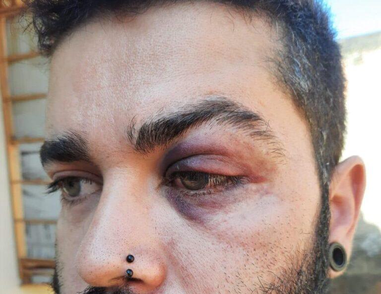 Cantor denuncia que foi agredido por PMs a mando de donos de transportadora de Senador Canedo