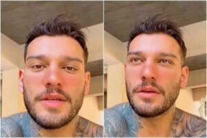 Veja famosos que fizeram procedimentos estéticos e odiaram o resultado