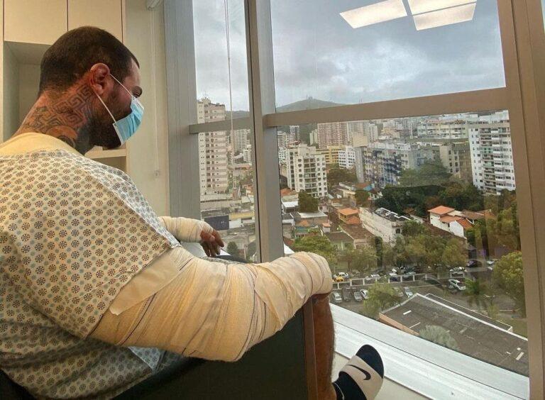 Leo Stronda tem 30% do corpo queimado com botijão de gás