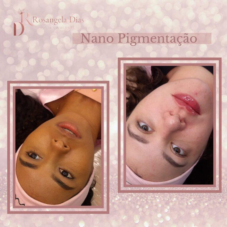 Conheça a revitalização labial, técnica que faz sucesso entre as mulheres