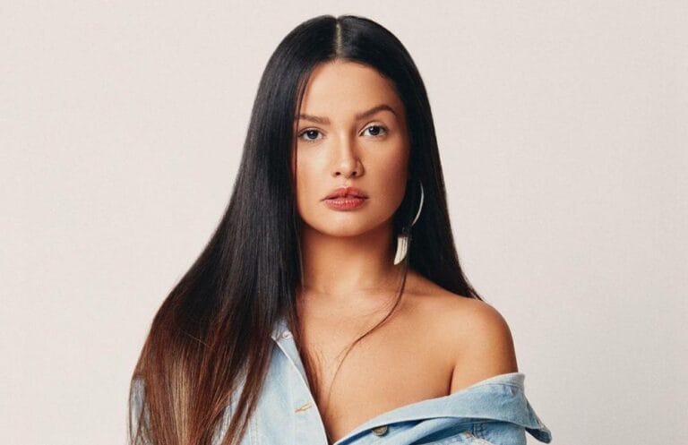 O que é a calvície feminina, a disfunção tratada por Juliette Freire