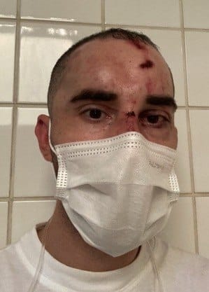 SP: fotógrafo sofre ataque homofóbico e é espancado ao deixar balada