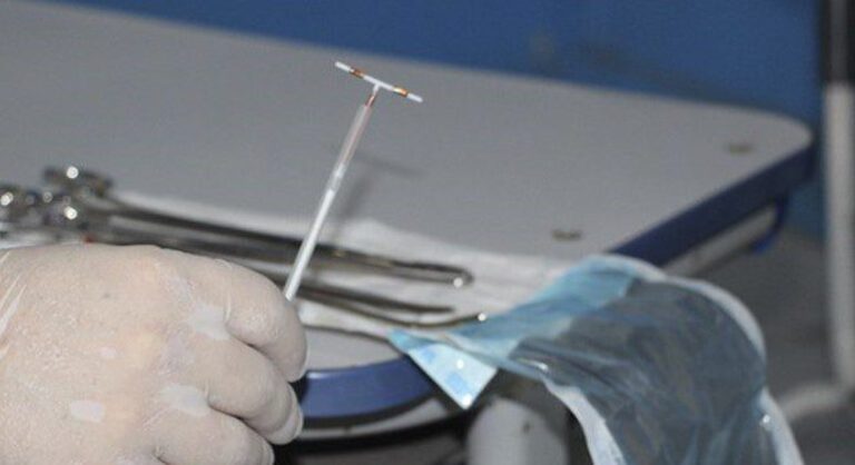 HULW vai realizar mutirão para colocação de DIU em usuárias do SUS
