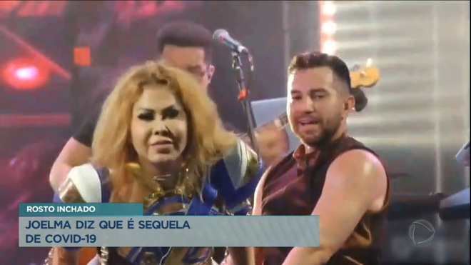 Joelma afirma que inchaço no rosto é sequela da Covid-19