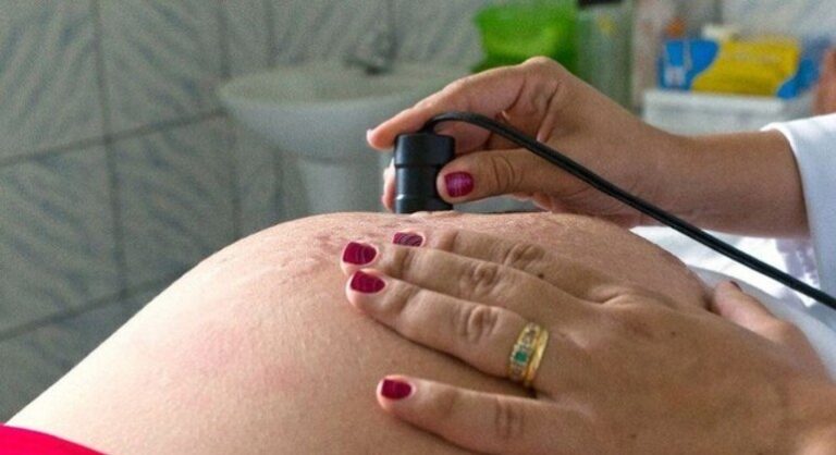 No Brasil, a taxa de gestantes com menos de 17 anos é de 57%
