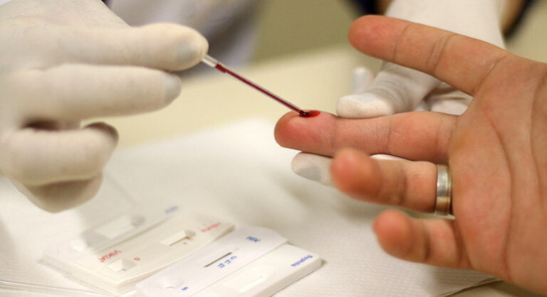 Prevalência de HIV dobra em 20 anos no Brasil, aponta relatório de programa das Nações Unidas