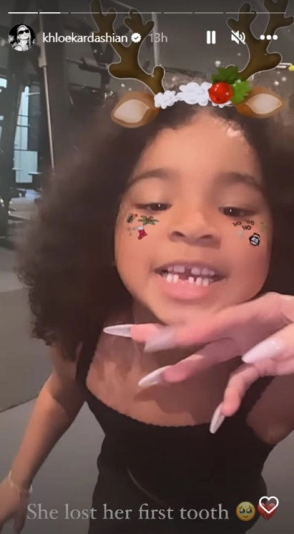 A fada dos dentes 'chegou' a casa de Khloé Kardashian