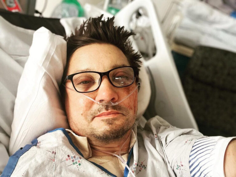 Foto da Semana: Jeremy Renner e as imagens impressionantes após acidente