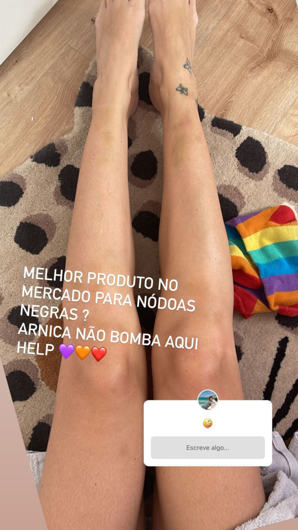 Jessica Athayde continua cheias de nódoas negras (por causa do Vale Tudo)