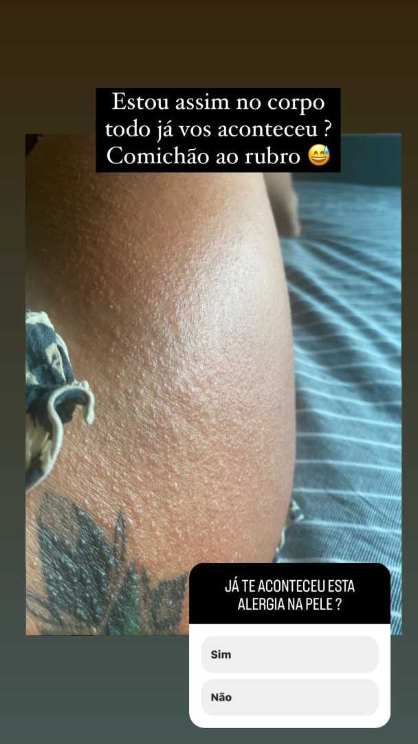 Bárbara Norton de Matos sofre com "alergia e febre" no Vietname