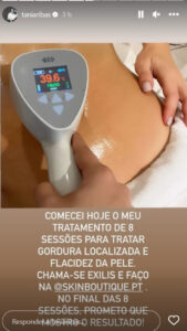 Tânia Ribas de Oliveira inicia procedimento estético