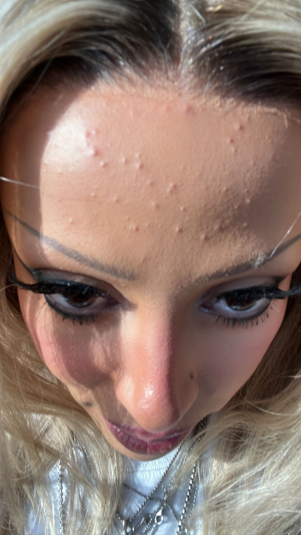 Doja Cat destaca testa cheia de borbulhas após vencer prémio