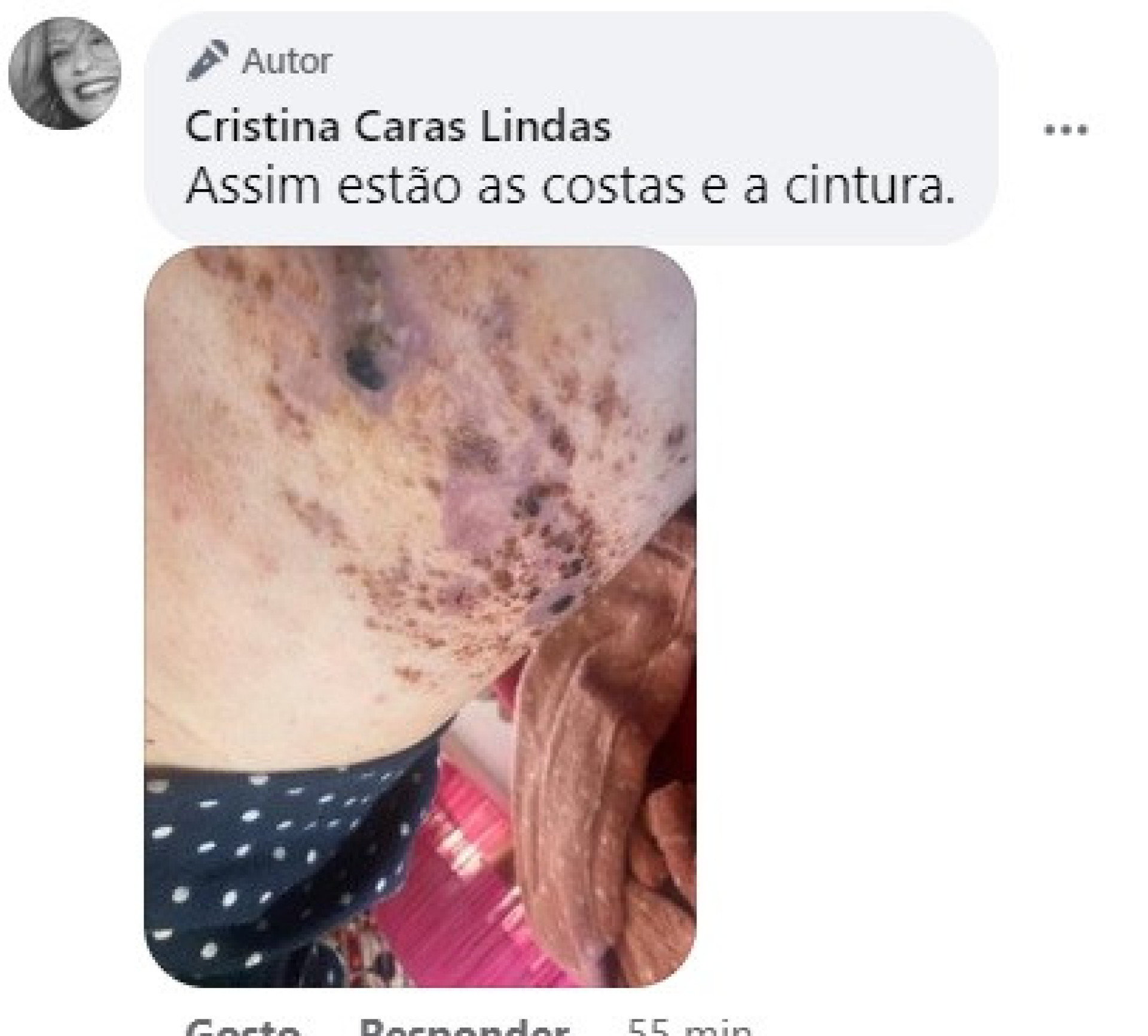 "Em grande sofrimento". Cristina Caras Lindas mostra foto 'arrepiante'