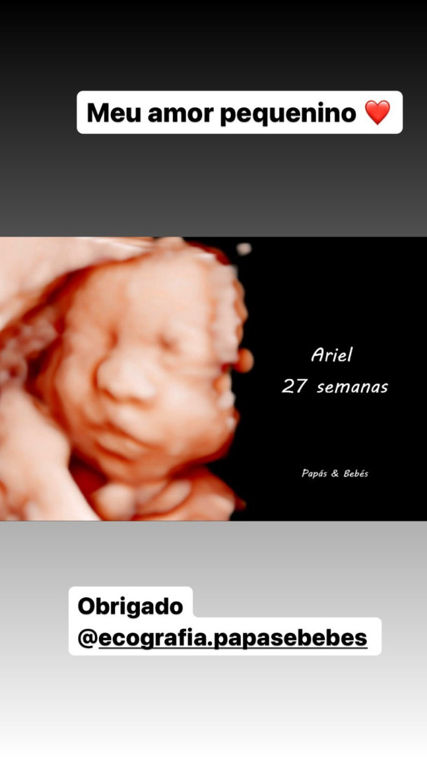 Sandrina Pratas revela foto do rosto da filha após ecografia