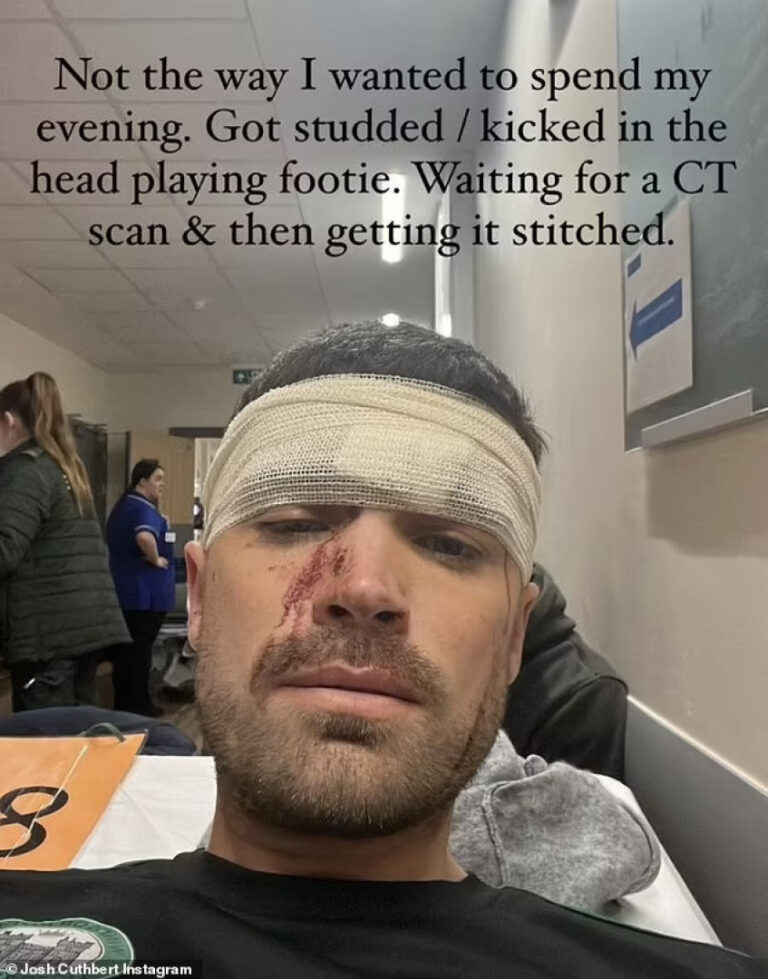 Cantor Josh Cuthbert hospitalizado após ser "pontapeado" na cabeça