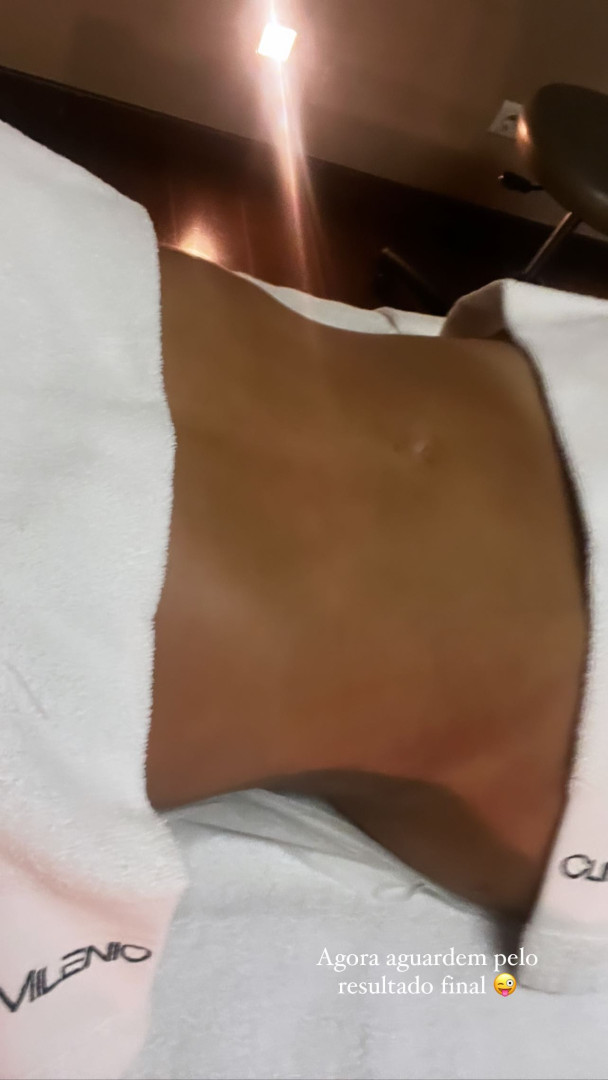 Joana Diniz mostra "incrível" resultado da cirurgia após duas semanas