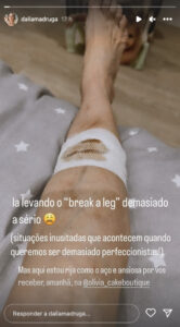 Dália Madruga mostra imagem arrepiante de lesão na perna
