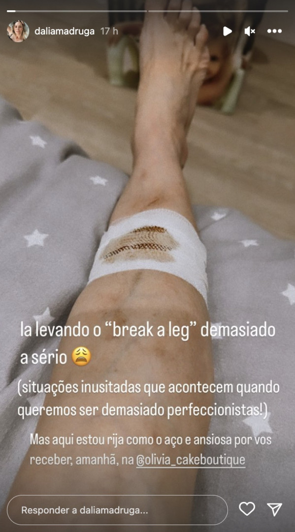 Dália Madruga mostra imagem arrepiante de lesão na perna