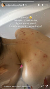 Andreia Rodrigues mostra fotografia da filha mais nova com varicela
