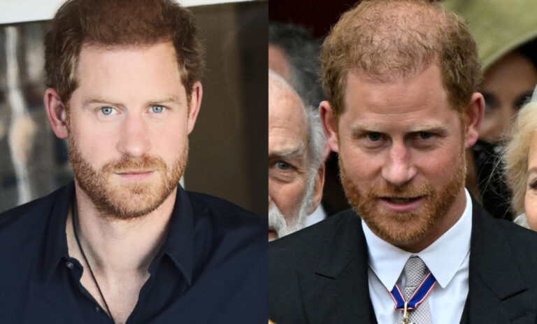 O que aconteceu ao cabelo do príncipe Harry?