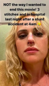 Rebel Wilson assistida de urgência. Atriz sofreu acidente em filmagens