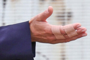 O que aconteceu à mão de Kate Middleton? Palácio esclarece