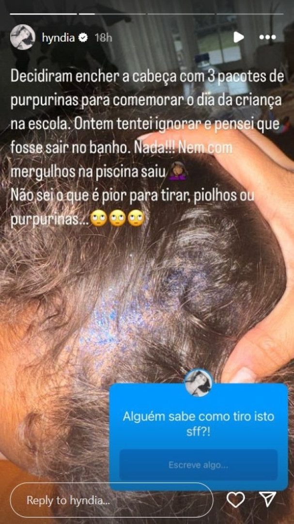 Rita Pereira: "Não sei o que é pior tirar: piolhos ou purpurinas"