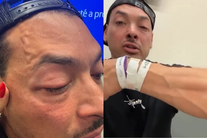 Deputado Felipe Franco denuncia PM após ter sido agredido em show do Chris Brown