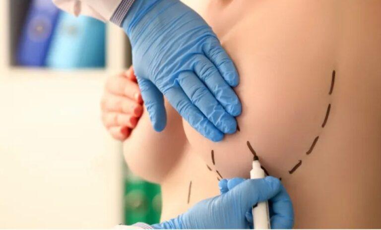 Mulher faz cirurgias plásticas e foge sem pagar hospital em BH