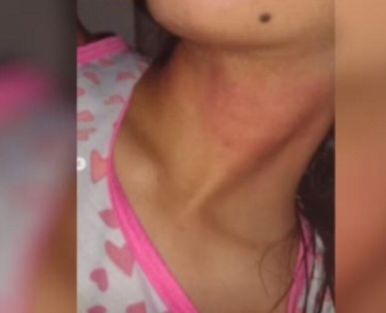 Pai é preso suspeito de agredir a filha em Aparecida de Goiânia