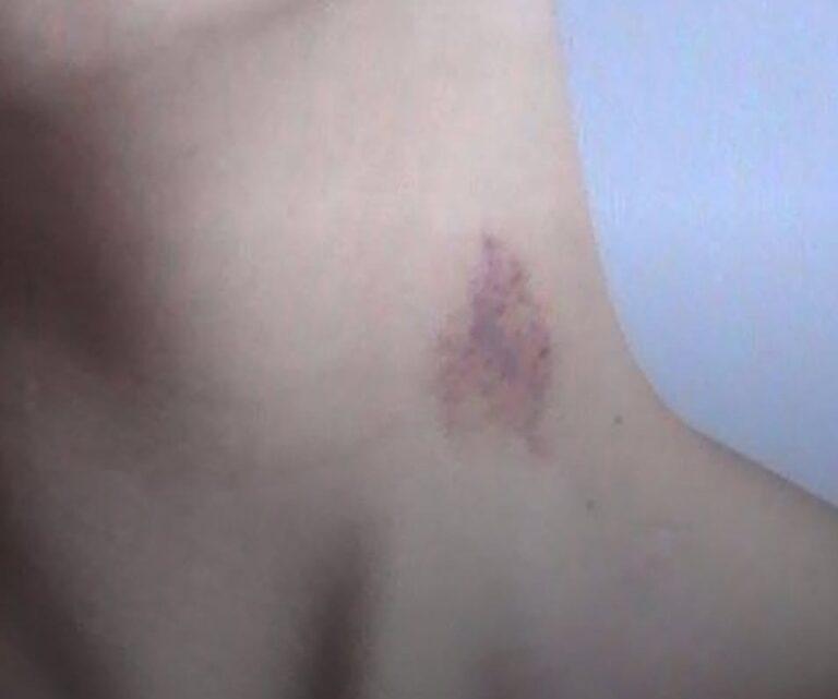 Mulher afirma para esposo ter sido atacada por um lobisomem em Macaíba