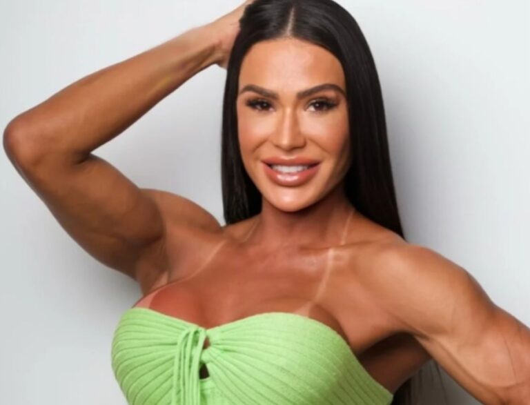 Gracyanne Barbosa passa por cirurgia e está fora do Dança dos Famosos