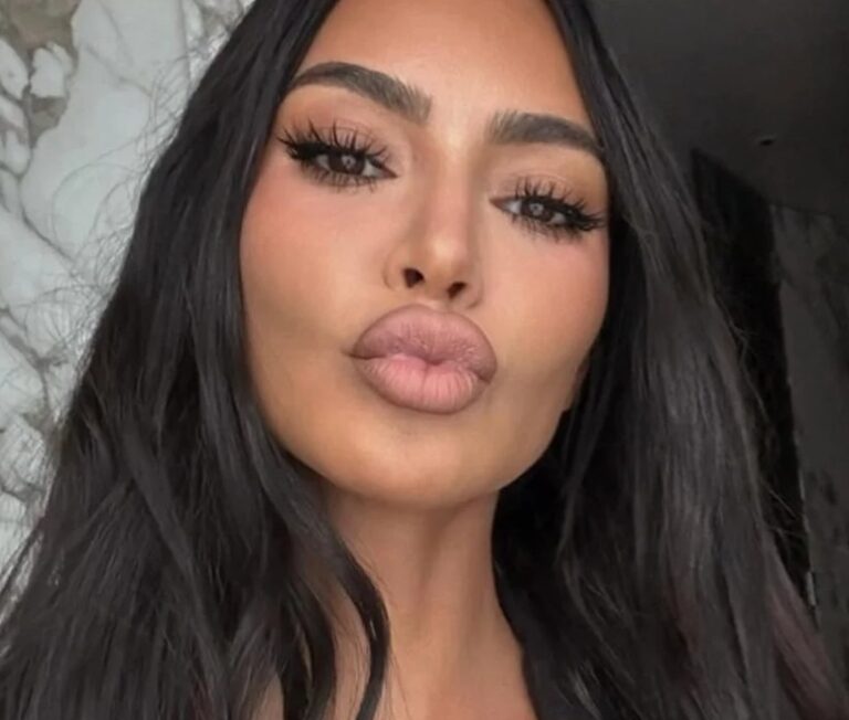Kim Kardashian revela diagnóstico de aneurisma cerebral