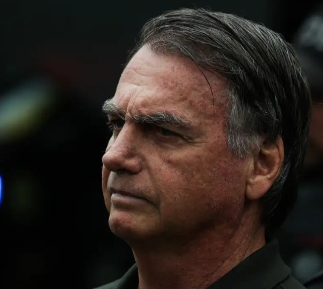 Peritos da PF  confirmam que Bolsonaro precisa passar por cirurgia