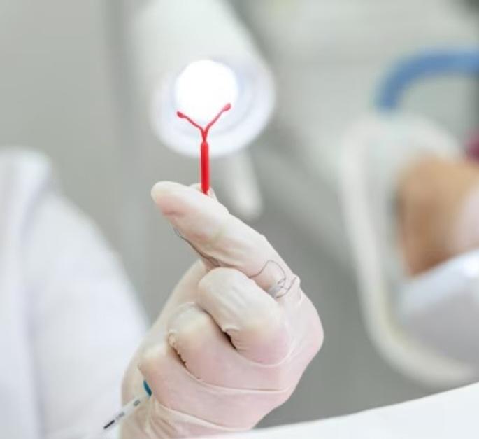 Governo de Goiás realiza mutirão de DIU em Goiânia e Aparecida