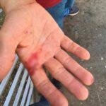 Homem  agride vizinho  com faca e rouba R$11 mil de sua conta bancária em Senador Canedo