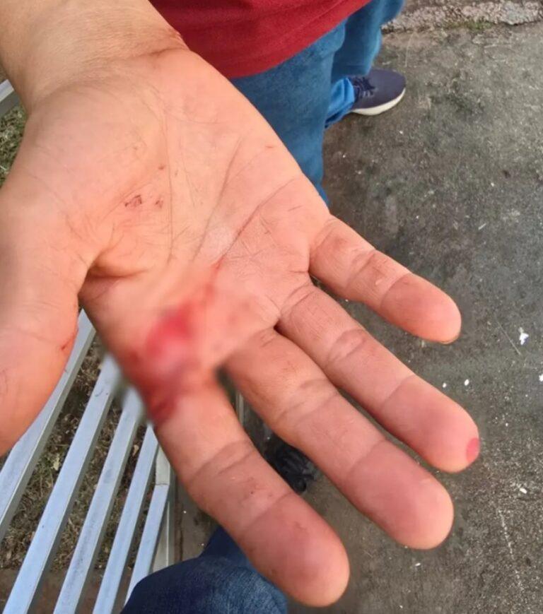 Homem  agride vizinho  com faca e rouba R$11 mil de sua conta bancária em Senador Canedo